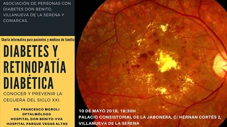 ACTIVIDADES DE NUESTRAS ASOCIACIONES: CHARLA SOBRE RETINOPATÍA DIABÉTICA